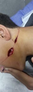 IMG-20250116-WA0018-108x300 بسبب وسامته تلميذ يشوه زميله بسفاجا