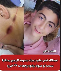 Screenshot_٢٠٢٥٠١١٦_١٧٥٩٥٠_InShot-259x300 بسبب وسامته تلميذ يشوه زميله بسفاجا